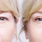 EyeGlow™ Levantaparpados